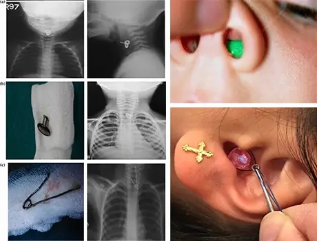 Ear Nasal Throat
